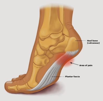 Are Work Boots Good for Plantar Fasciitis?, by Dave Ten